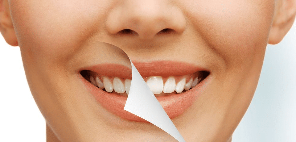 Tratamentos Caseiros para Clarear os Dentes