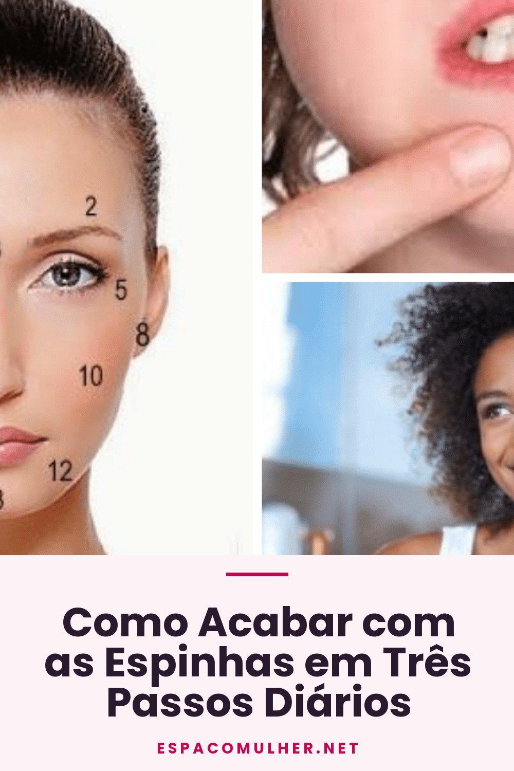Como Acabar com as Espinhas em Três Passos Diários