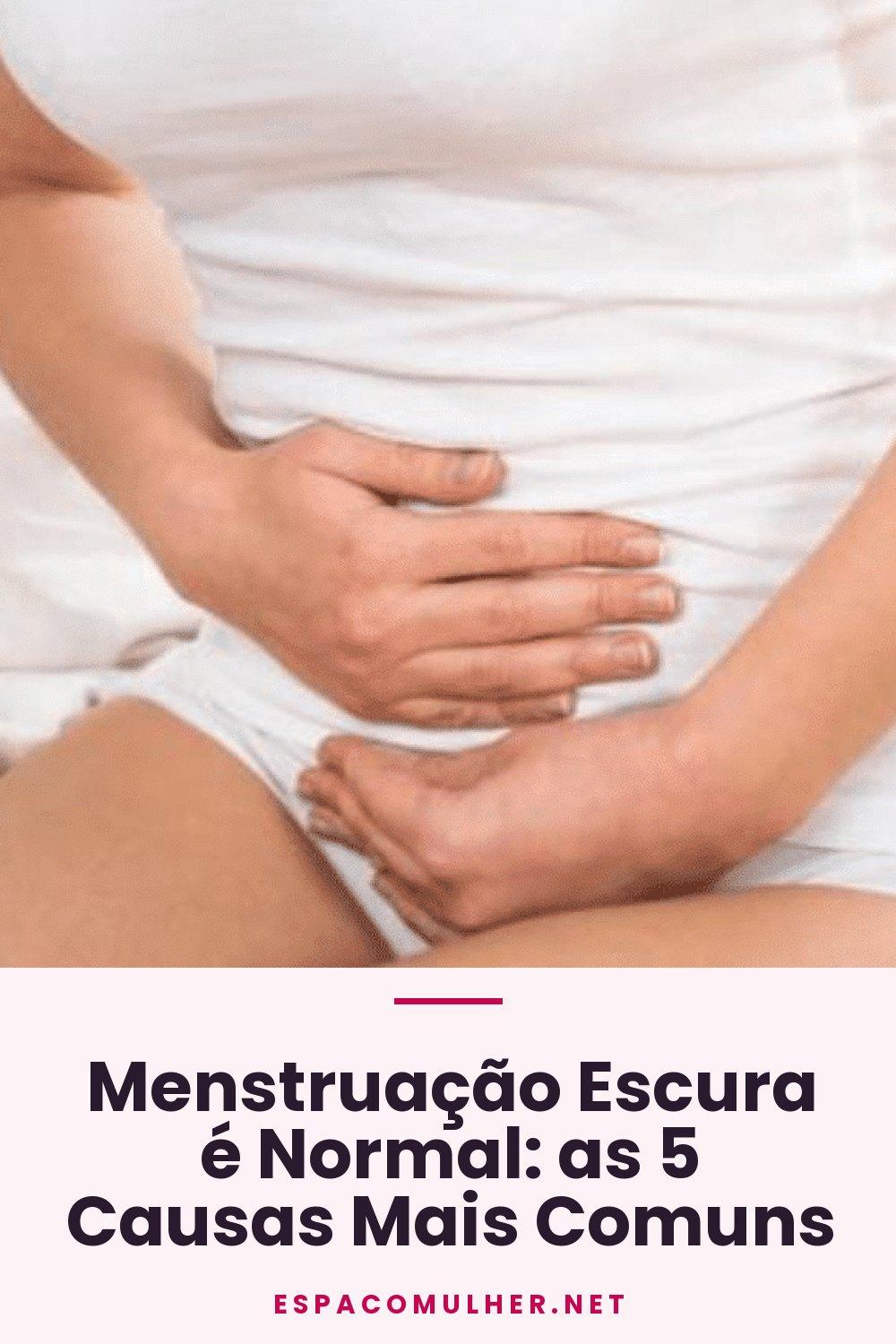 Menstruação Escura é Normal: as 5 Causas Mais Comuns