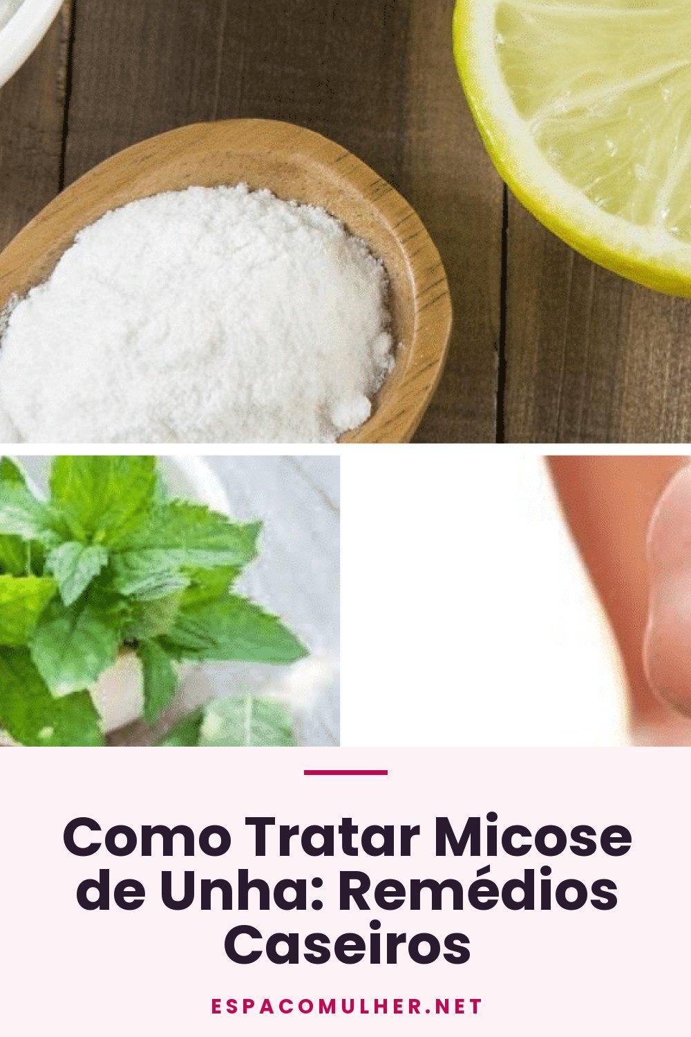 Como Tratar Micose de Unha: Remédios Caseiros