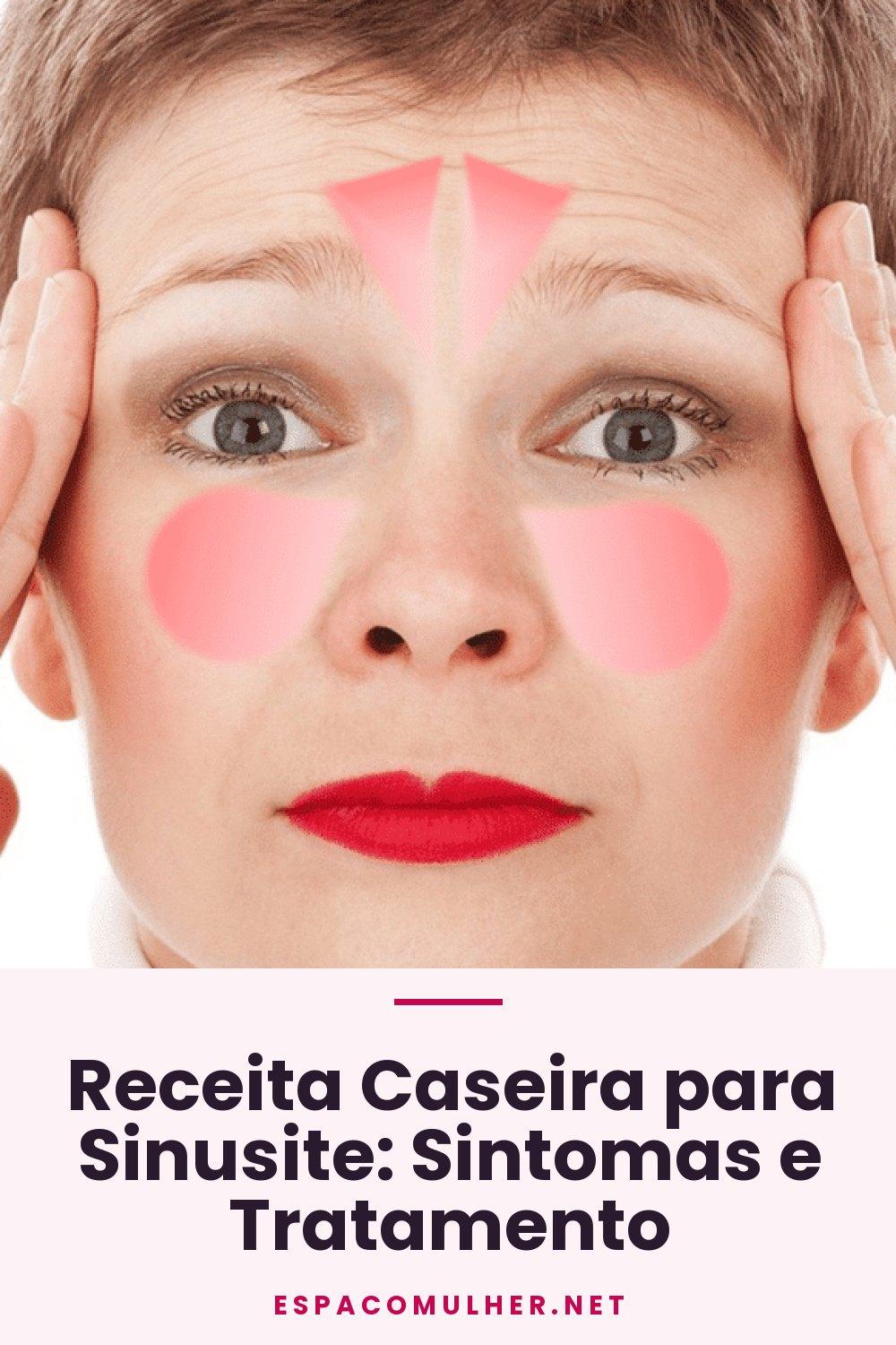 Receita Caseira para Sinusite: Sintomas e Tratamento