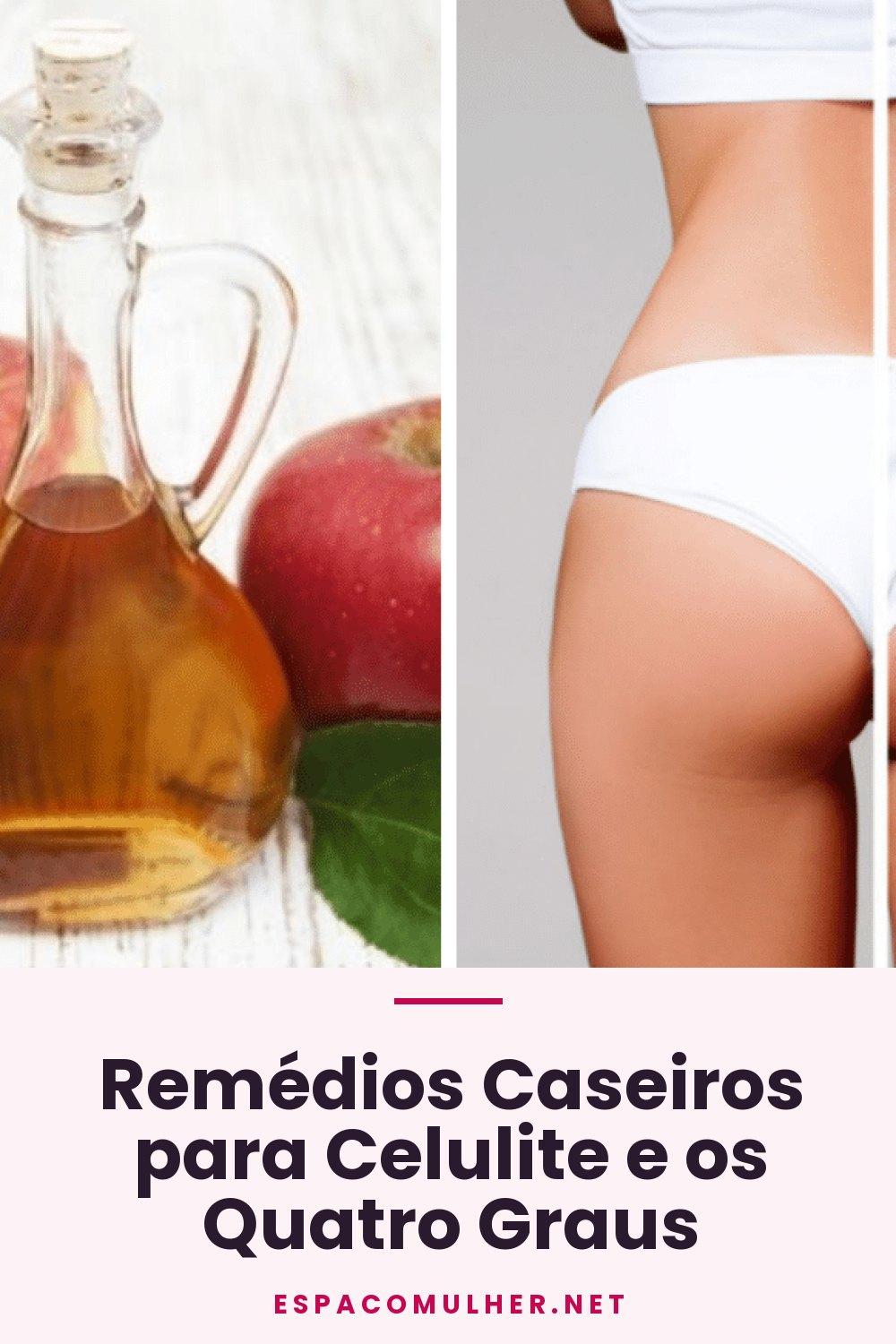 Remédios Caseiros para Celulite e os Quatro Graus