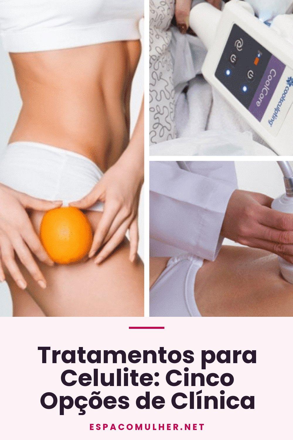 Tratamentos para Celulite: Cinco Opções de Clínica